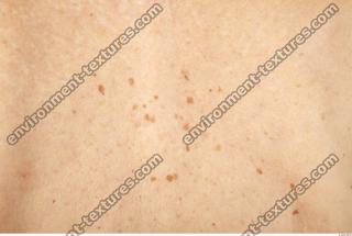 human skin white 0005